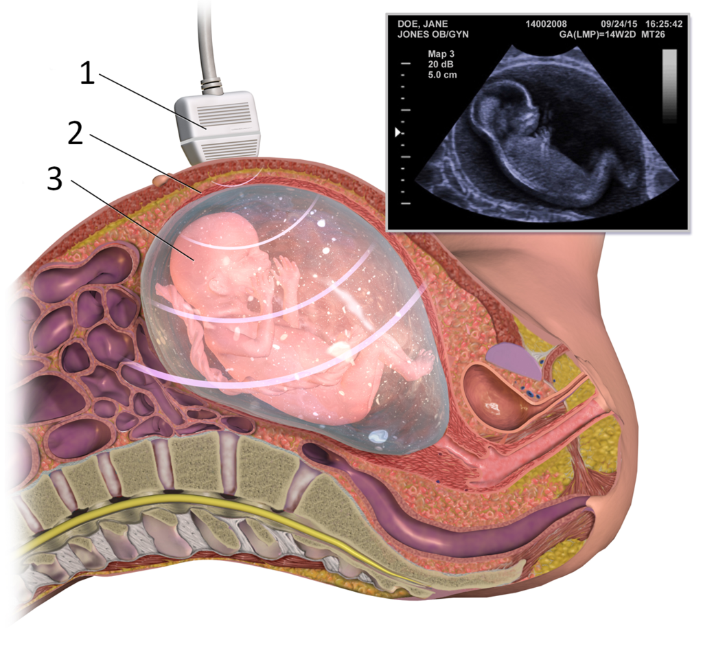 Fetal Ultrasound